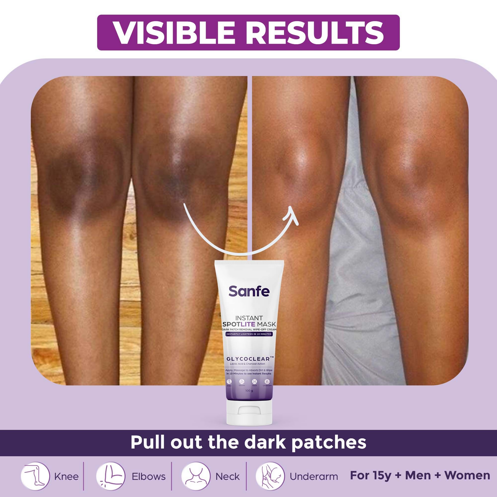 Sanfe Instant Spotlite Mask For Dark Underarm