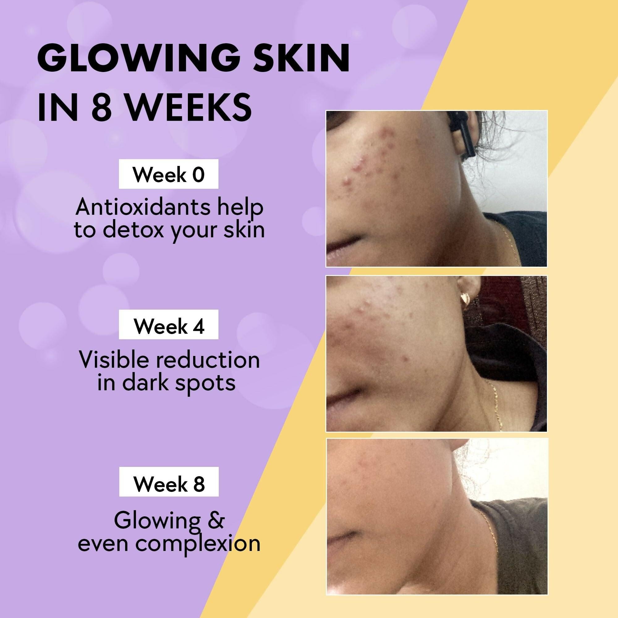 Chicnutrix Glow 500mg Effervescent Tablets - Black Currant Flavour Antioxidants For Clear, Glowing Skin