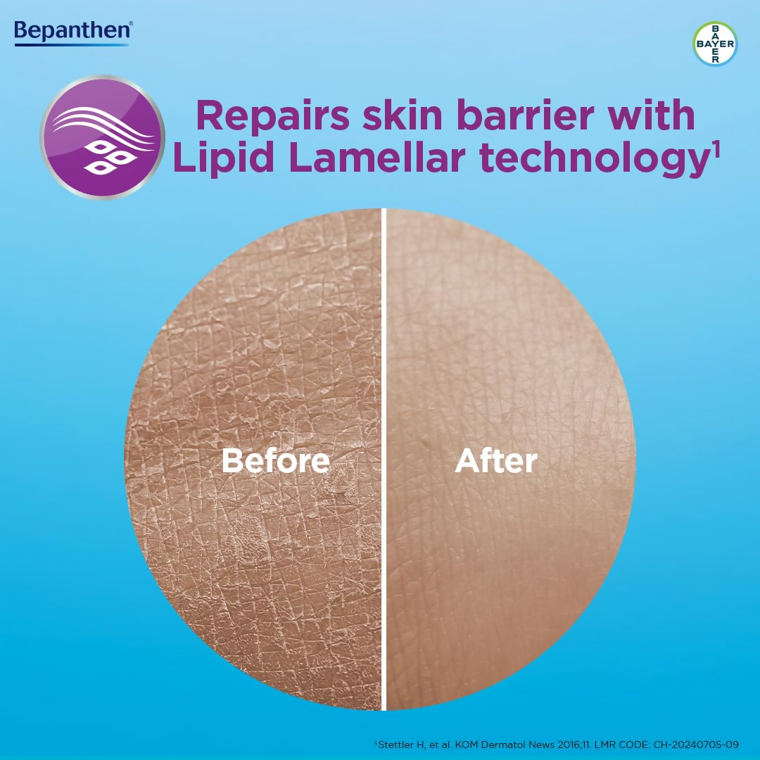 Bepanthen SensiCalm Cream For Face & Body