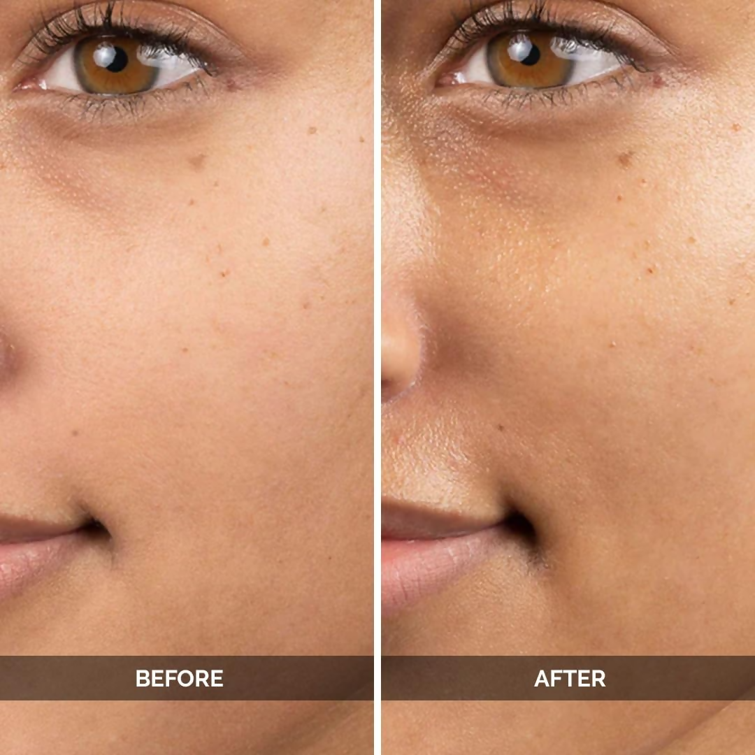 LuxaDerme Korean Ultra Brightening Face Serum