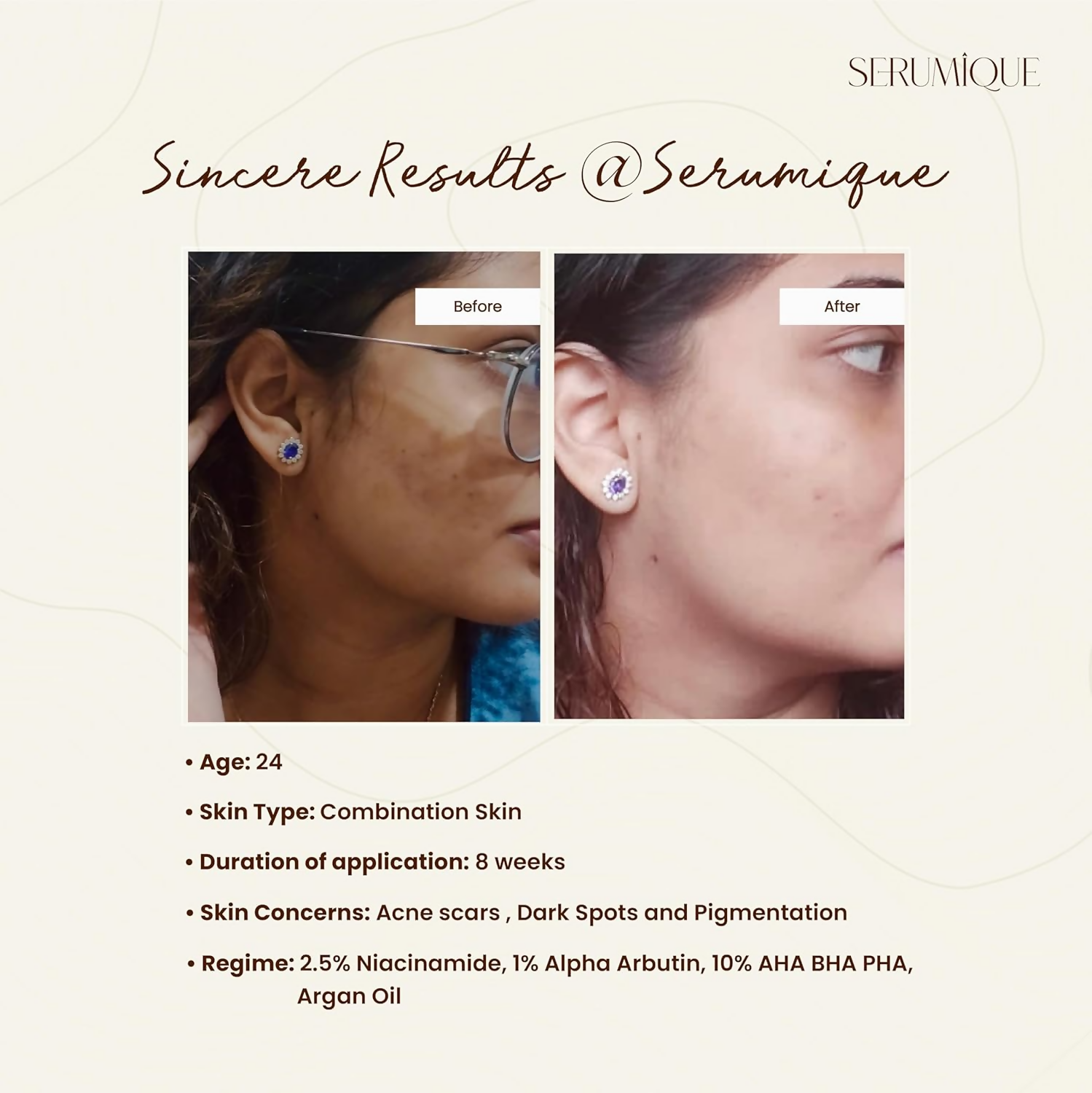 Serumique Niacinamide Face Serum - Hello Even Tone Pro Conc. 2.5%