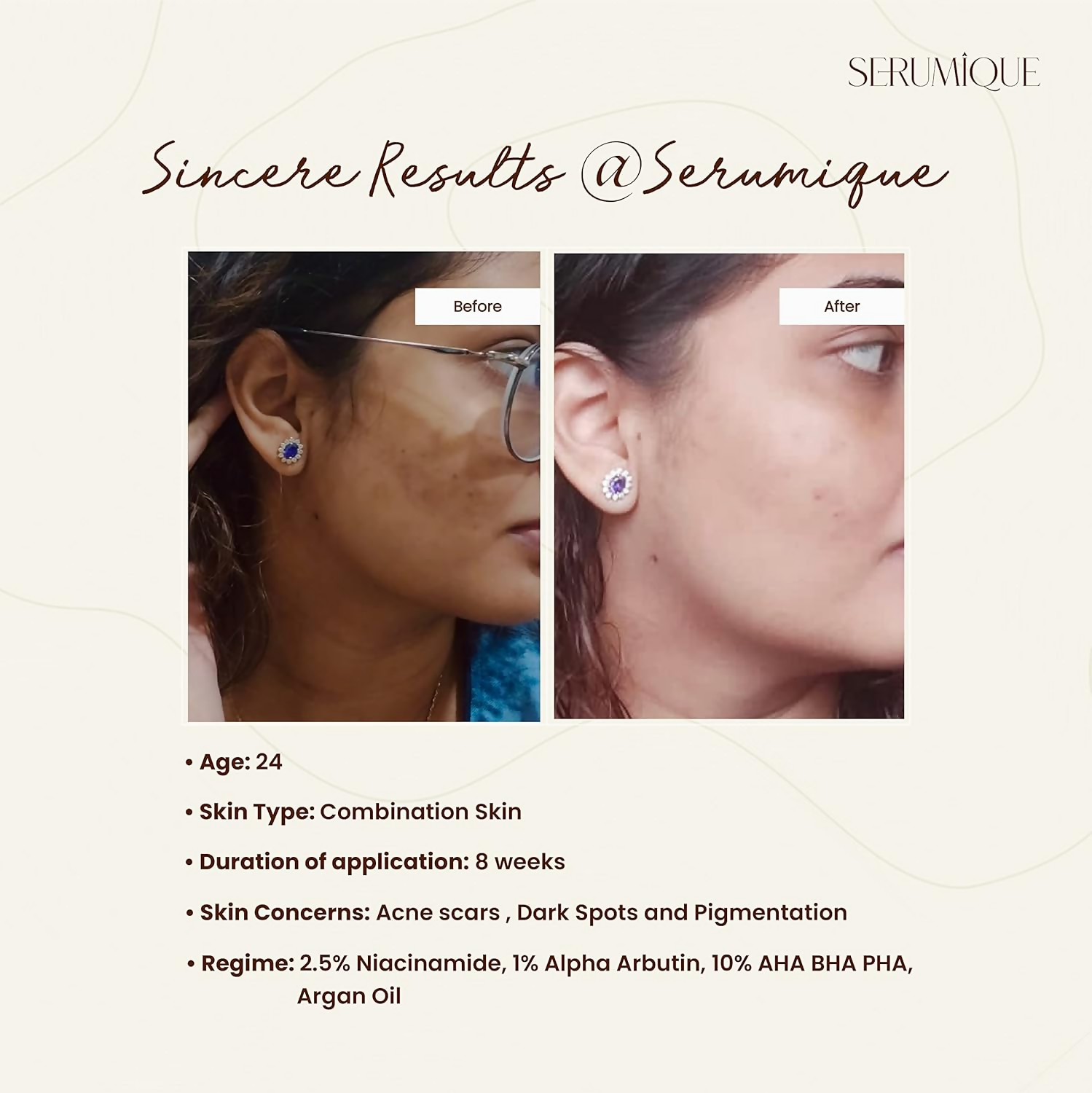 Serumique Niacinamide Face Serum - Hello Even Tone Pro Conc . 5%