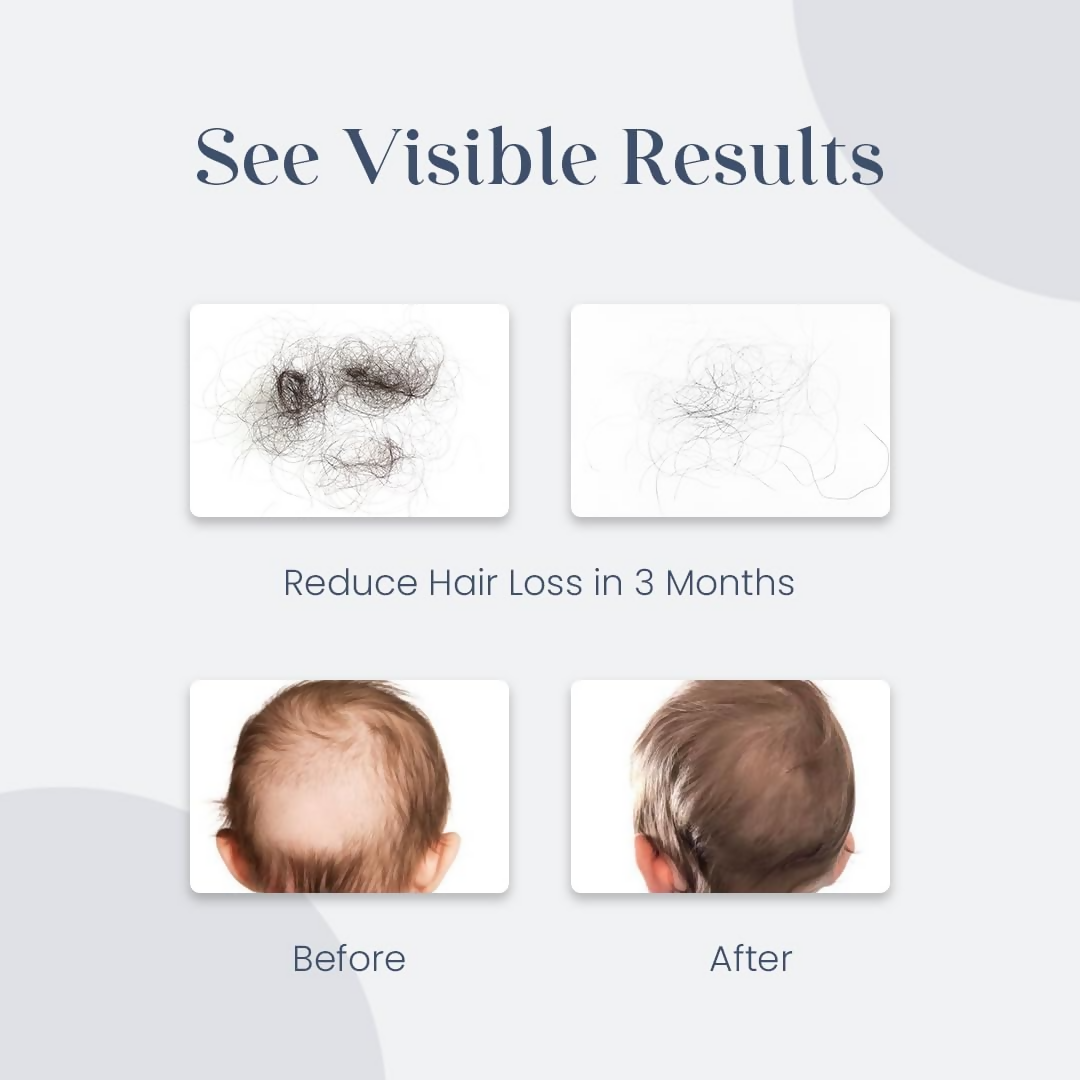 O'Mumsie Baby Hair Growth & Scalp Care Oil