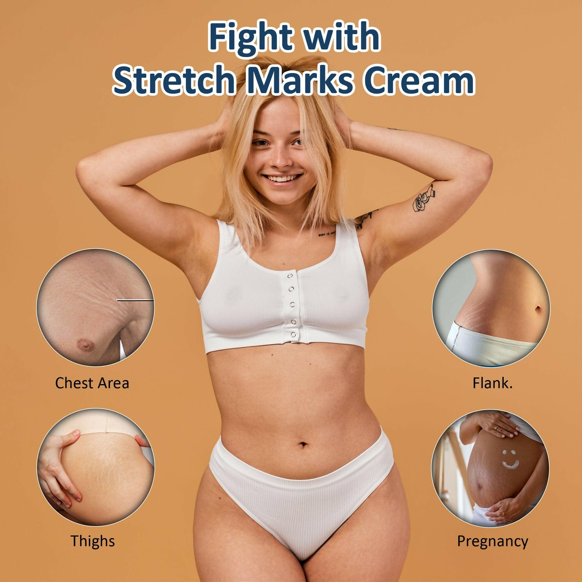 7 Days Natural Stretch Marks Scar Removal Cream Oil