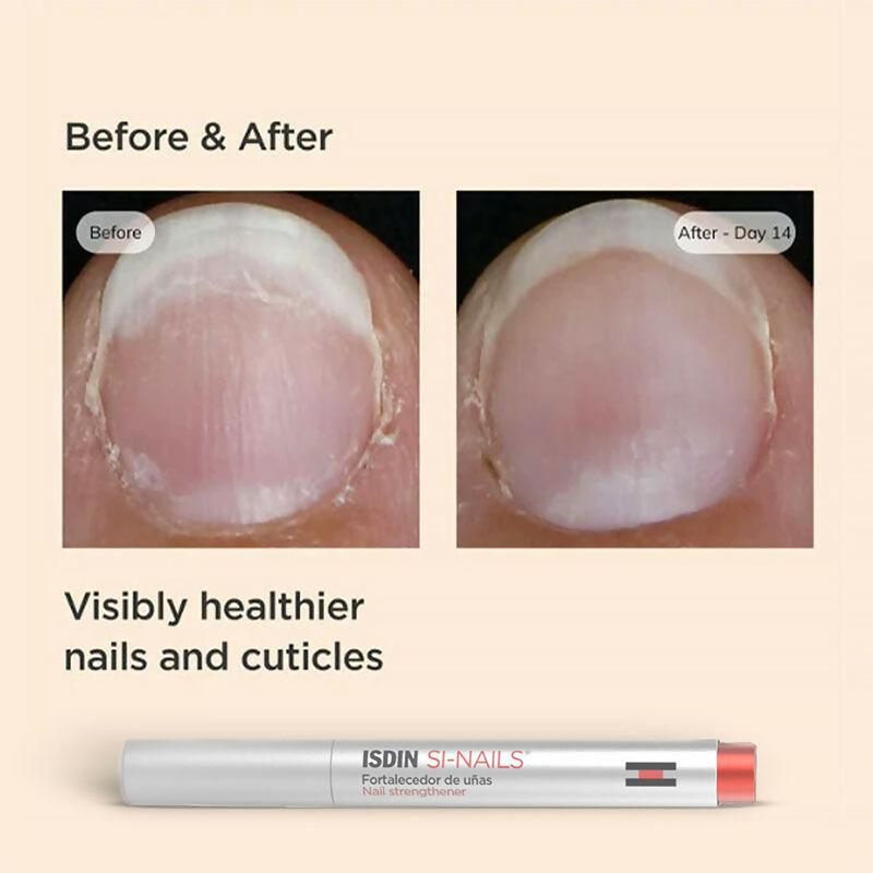 ISDIN Si-Nails Strengthener