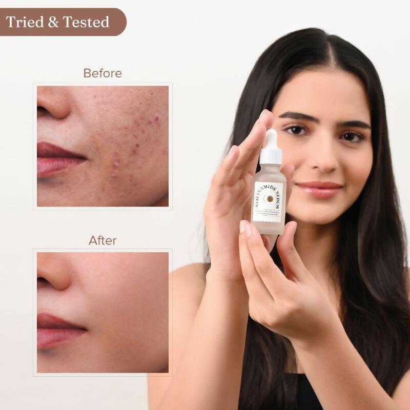 Dromen & Co Niacinamide Serum - Fights acne & blemishes Tighten Pores