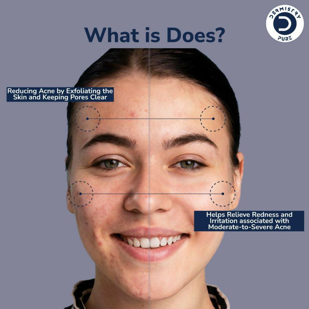 Dermistry Pure 2% Salicylic Acid 2% Zinc Face Serum For Oily Acne Prone Skin Black & Whitehead Scars