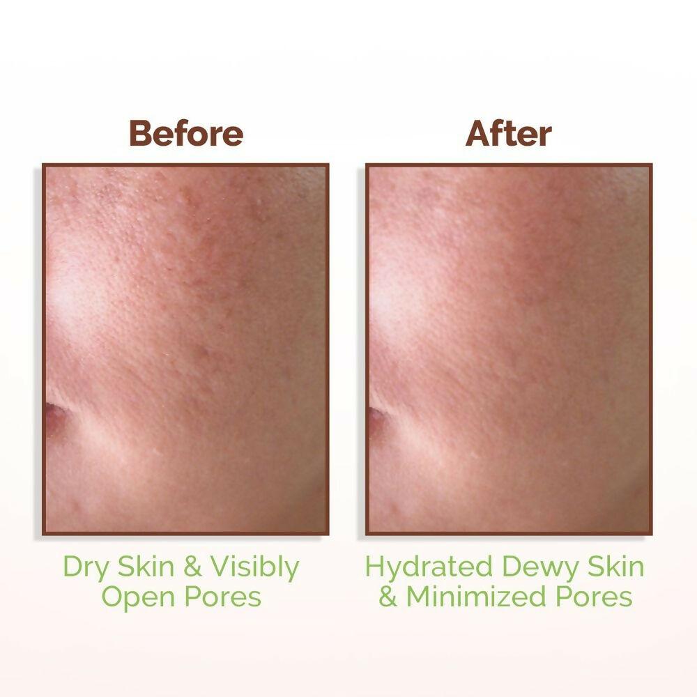 Mamaearth Rice Water Dewy Face Toner with 96% Pure Rice Water Extract & 4% Niacinamide for Glass Skin