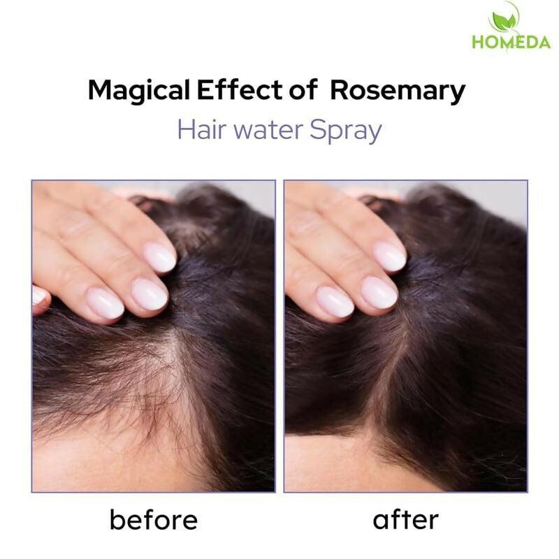 Homeda Rosemary Water For Hair Growth