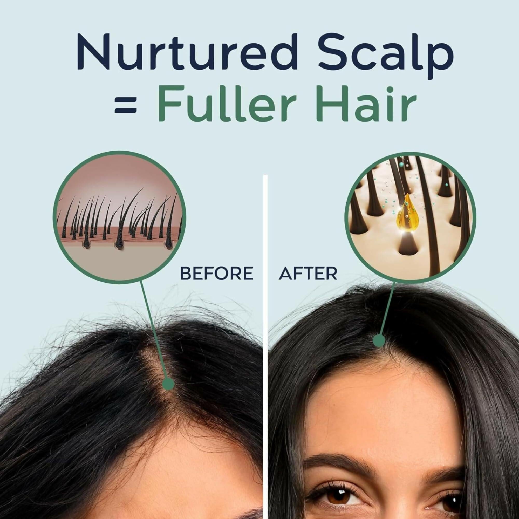 Hair Harmony Rosemary Water Spray For Hair Growth