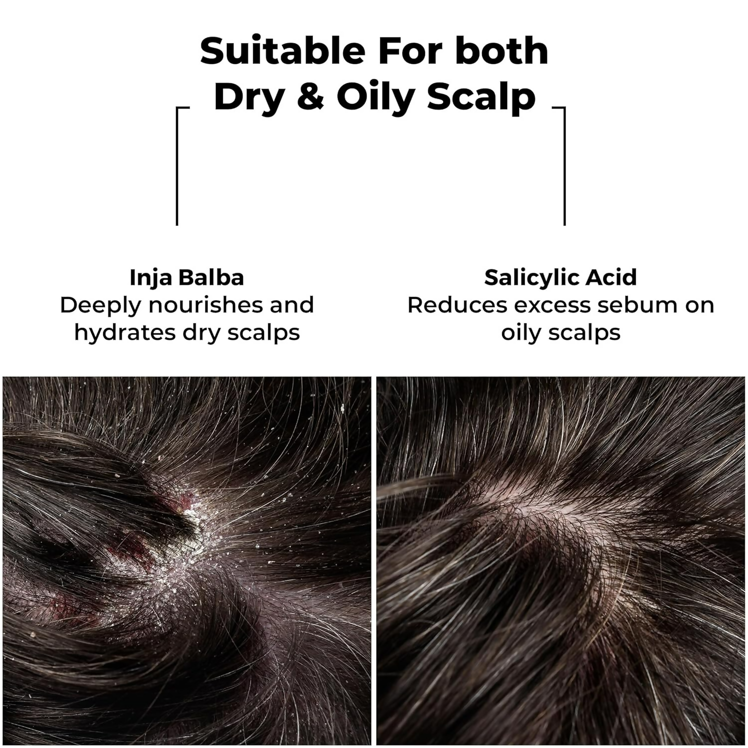 Brillare Dandruff Control Shampoo