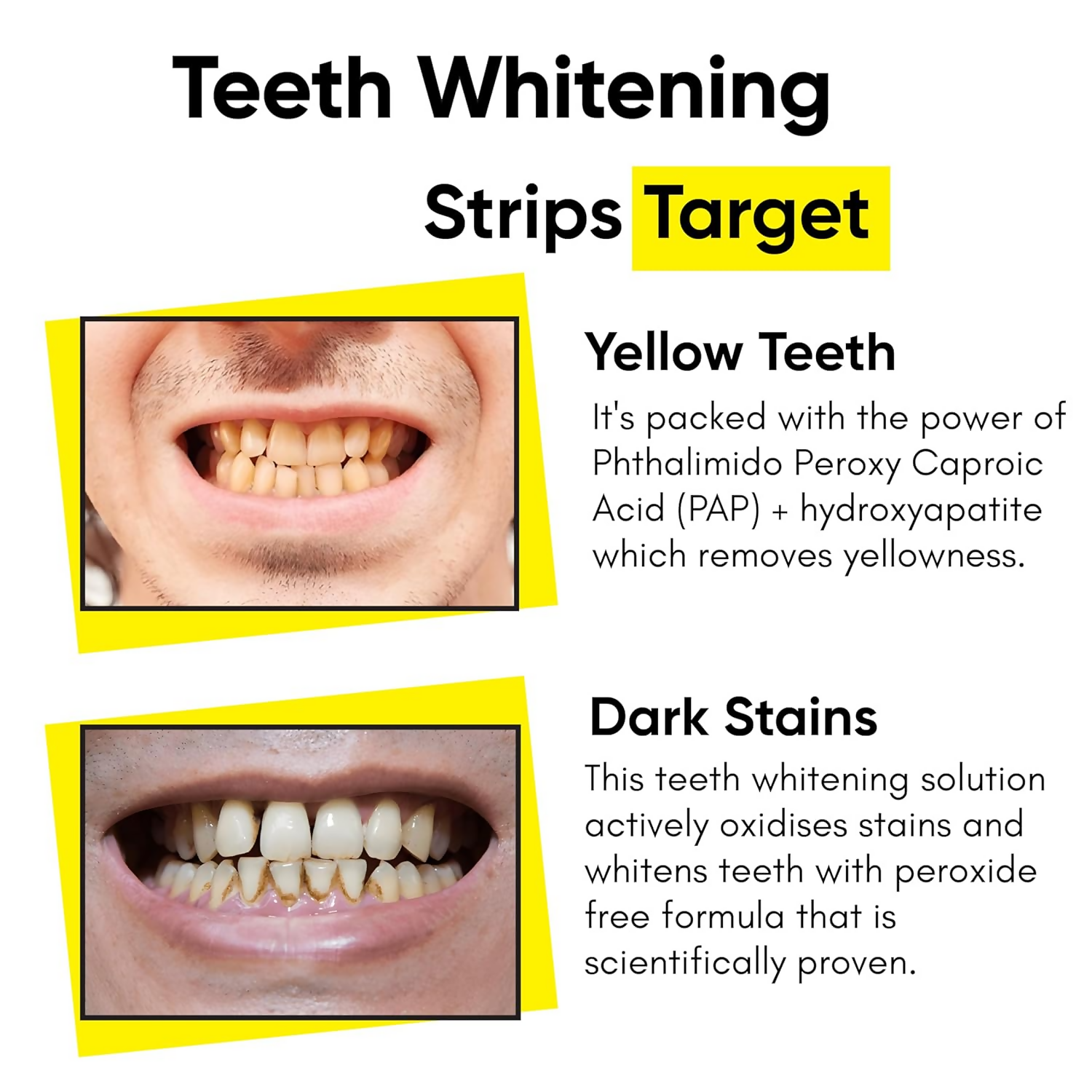 Masofta Professional Teeth Whitening Strips With PAP+ For Yellow and Dark Stains