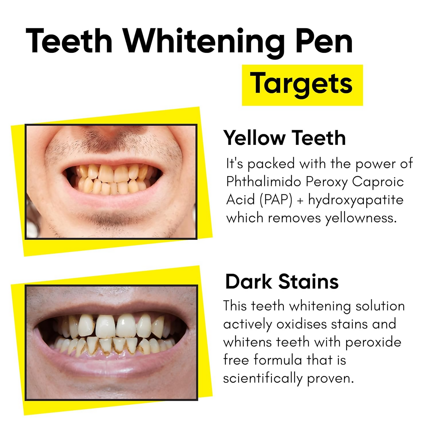 Masofta Teeth Whitening Pen With PAP+ For Yellow and Dark Stains