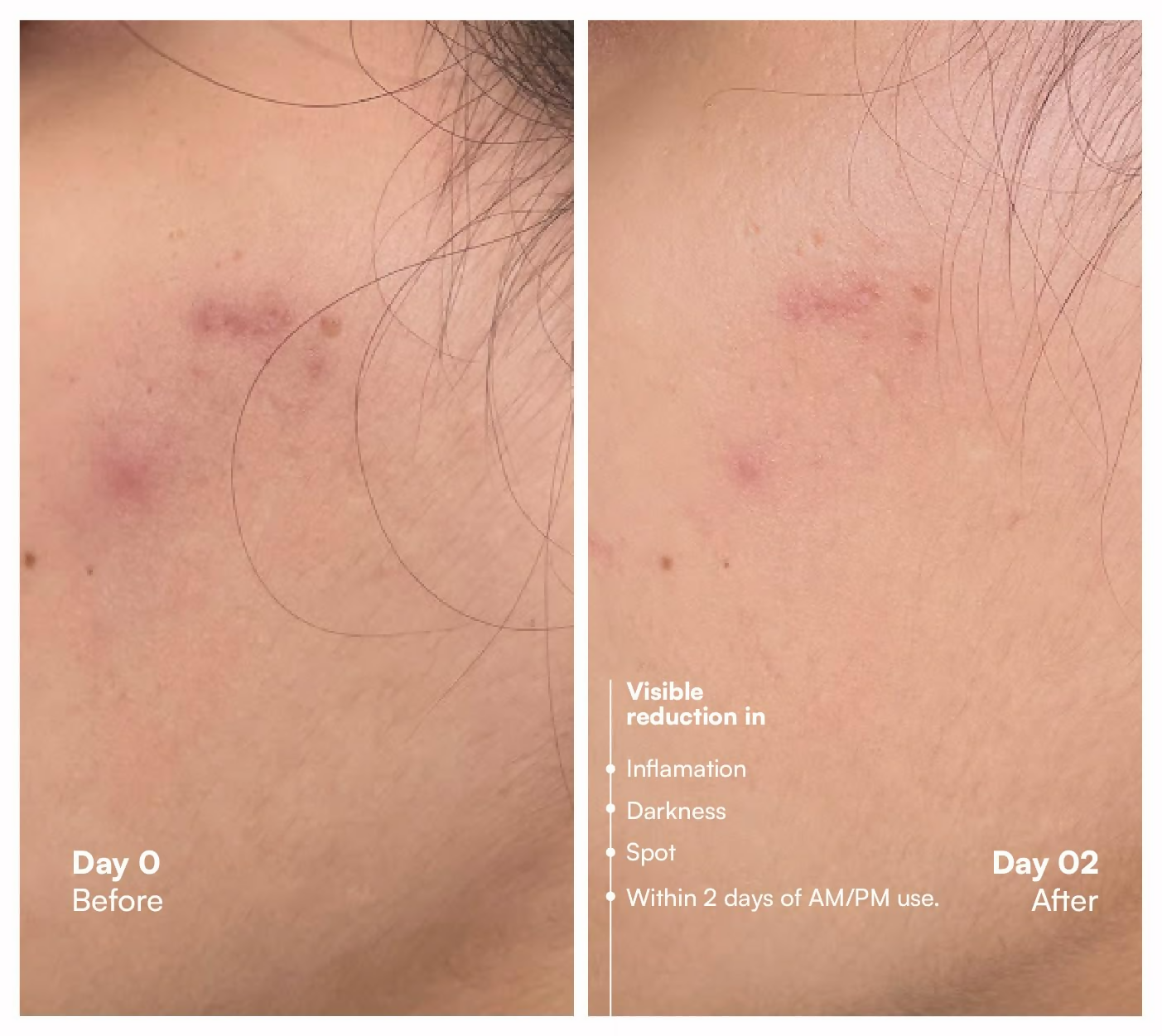 Awear Beauty Glass Skin Dual Spot Treatment