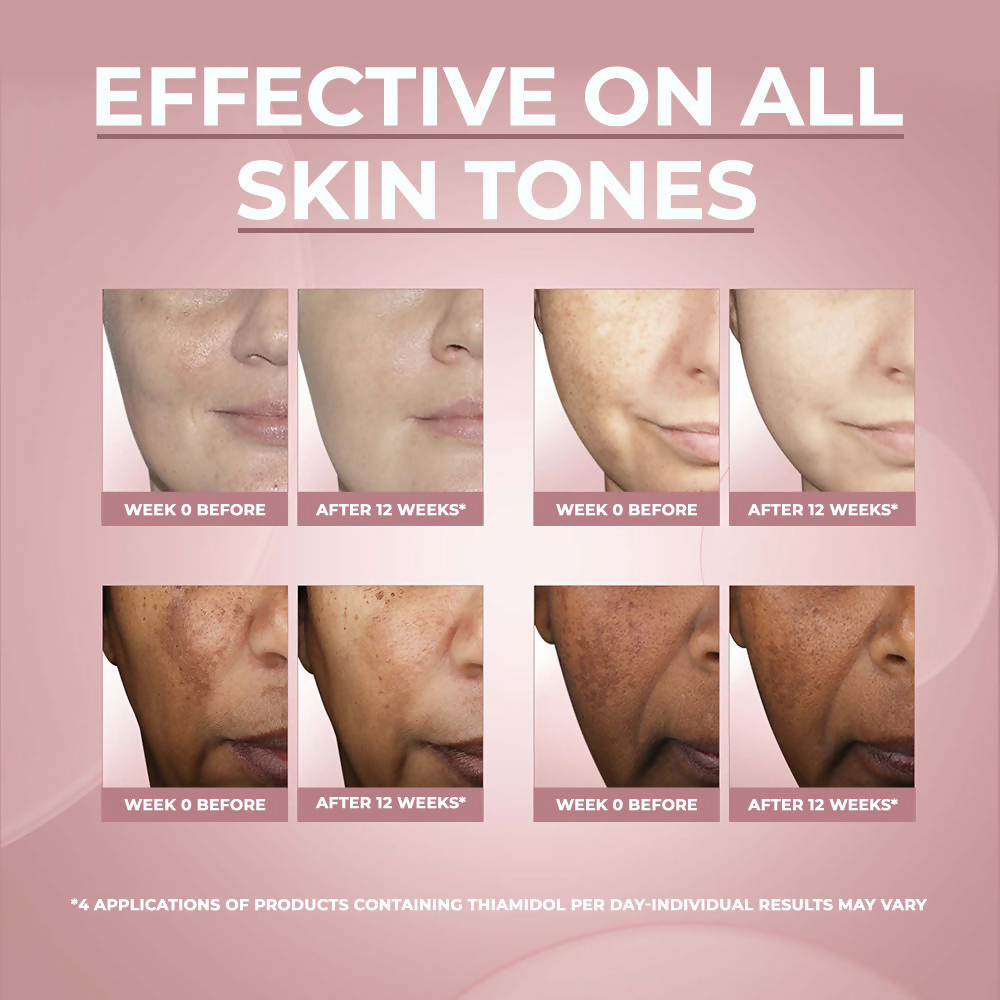 Eucerin Anti-Pigment Day Cream With SPF 30