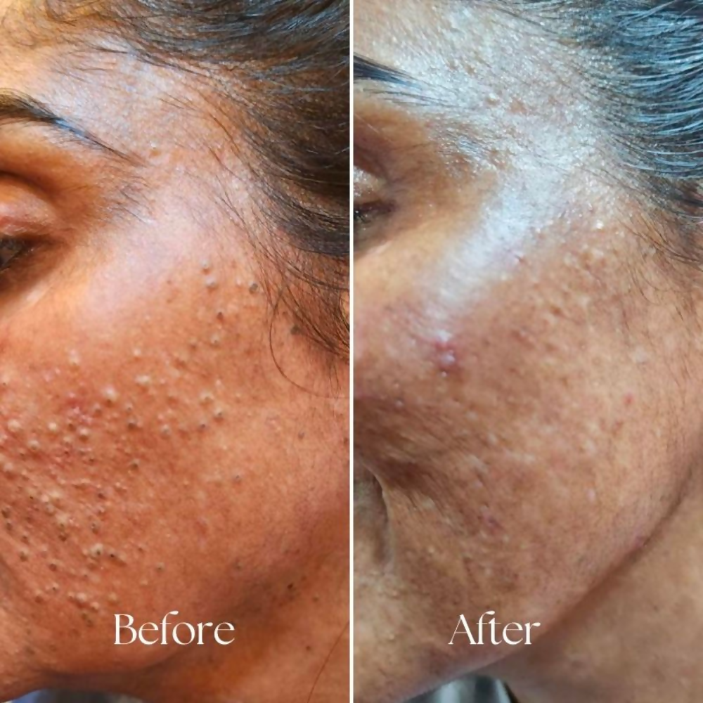 BiE Superpower Eternal Youth Cream With Collagen Boosters For Brightening & Anti-Aging