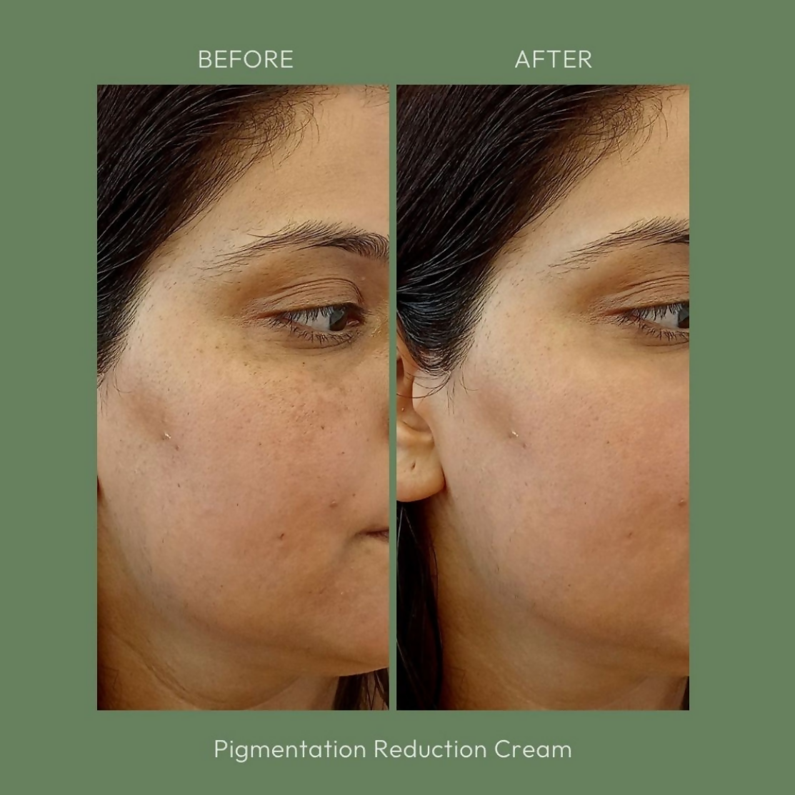 House of Beauty Pigmentation Reduction Cream
