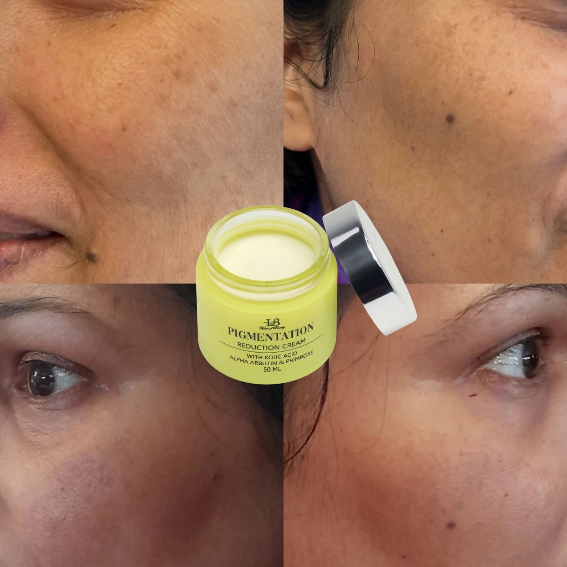 House of Beauty Pigmentation Reduction Cream