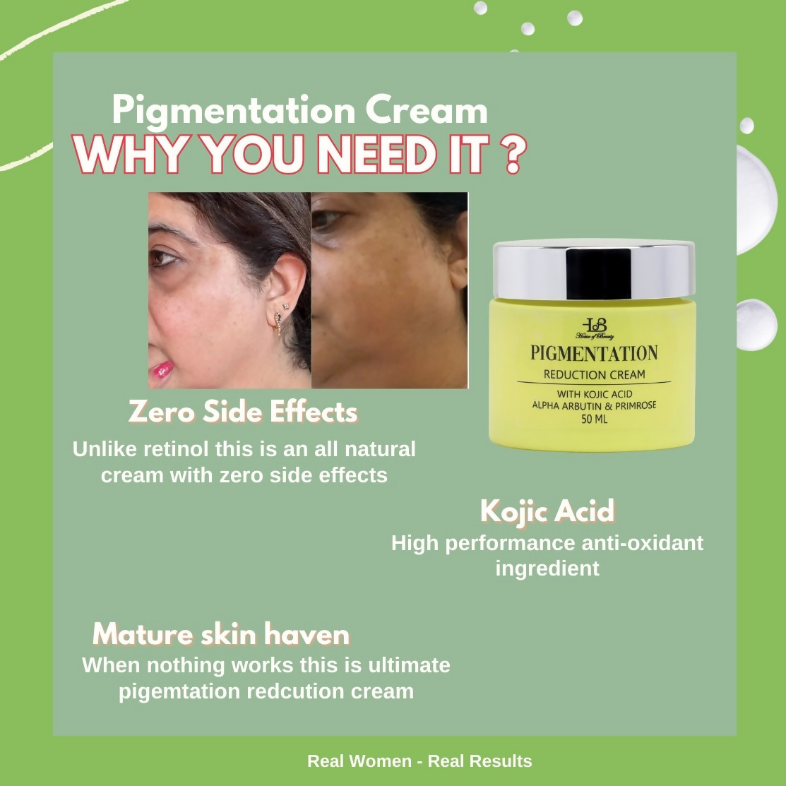 House of Beauty Pigmentation Reduction Cream