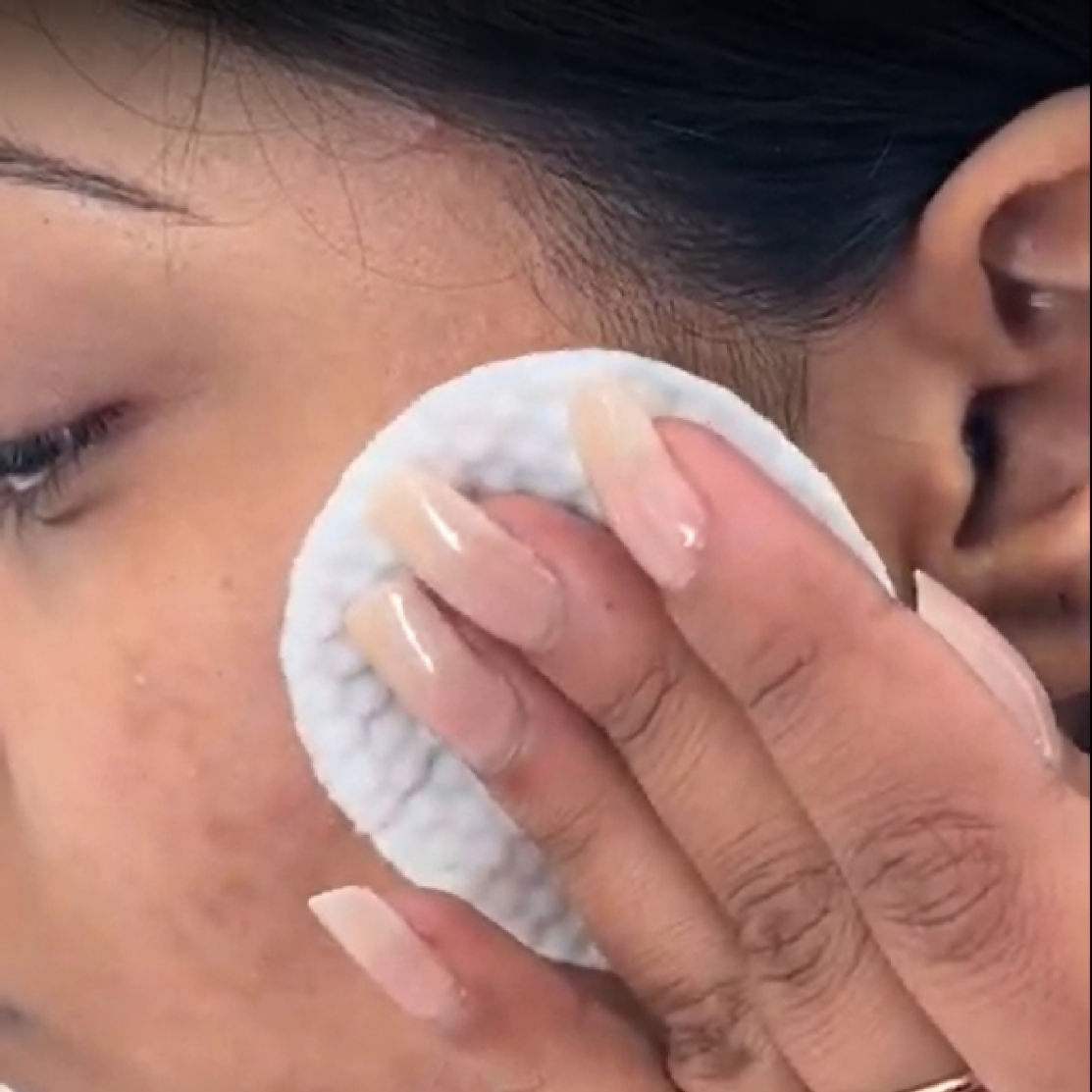 House of Beauty Anti Pimple Wipes