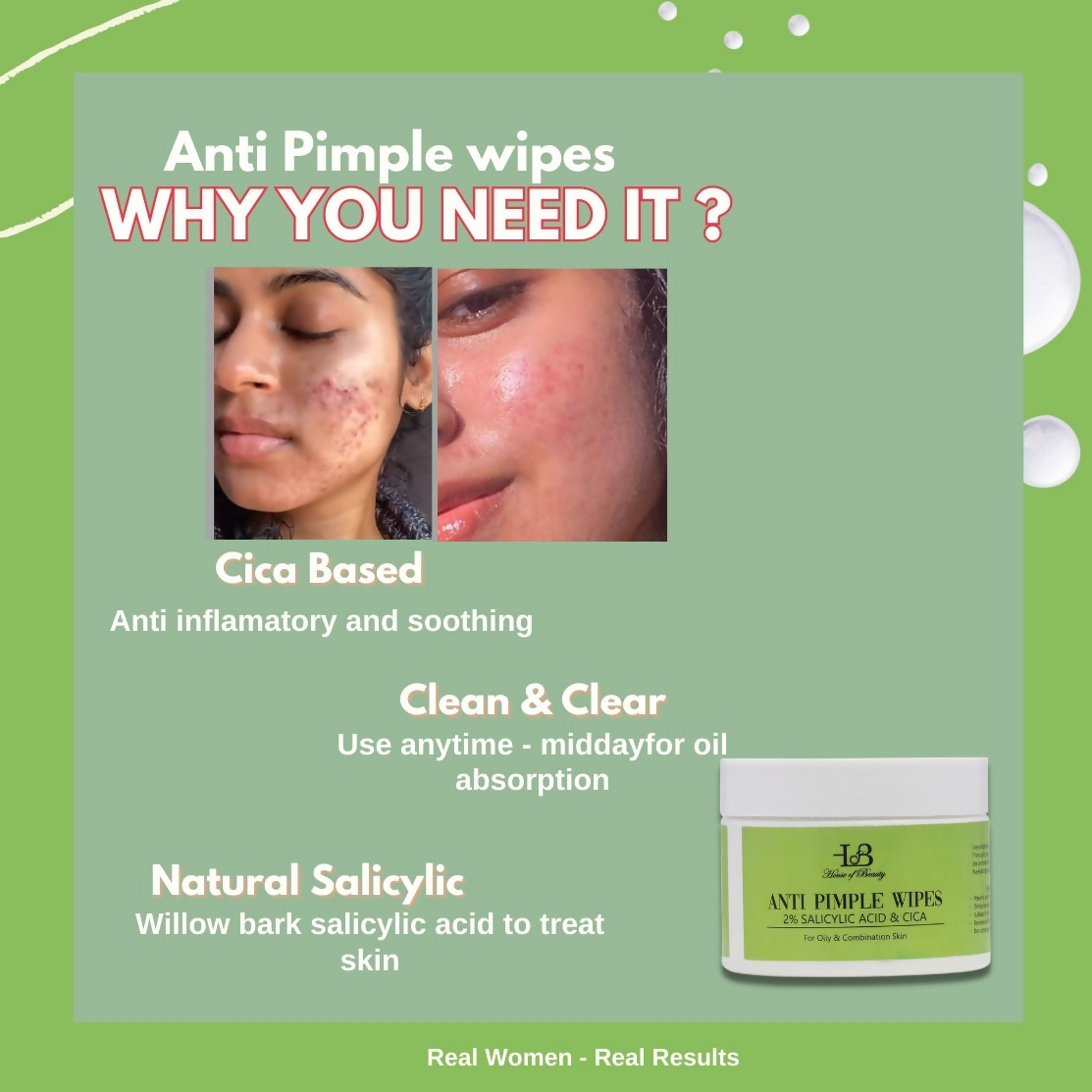 House of Beauty Anti Pimple Wipes
