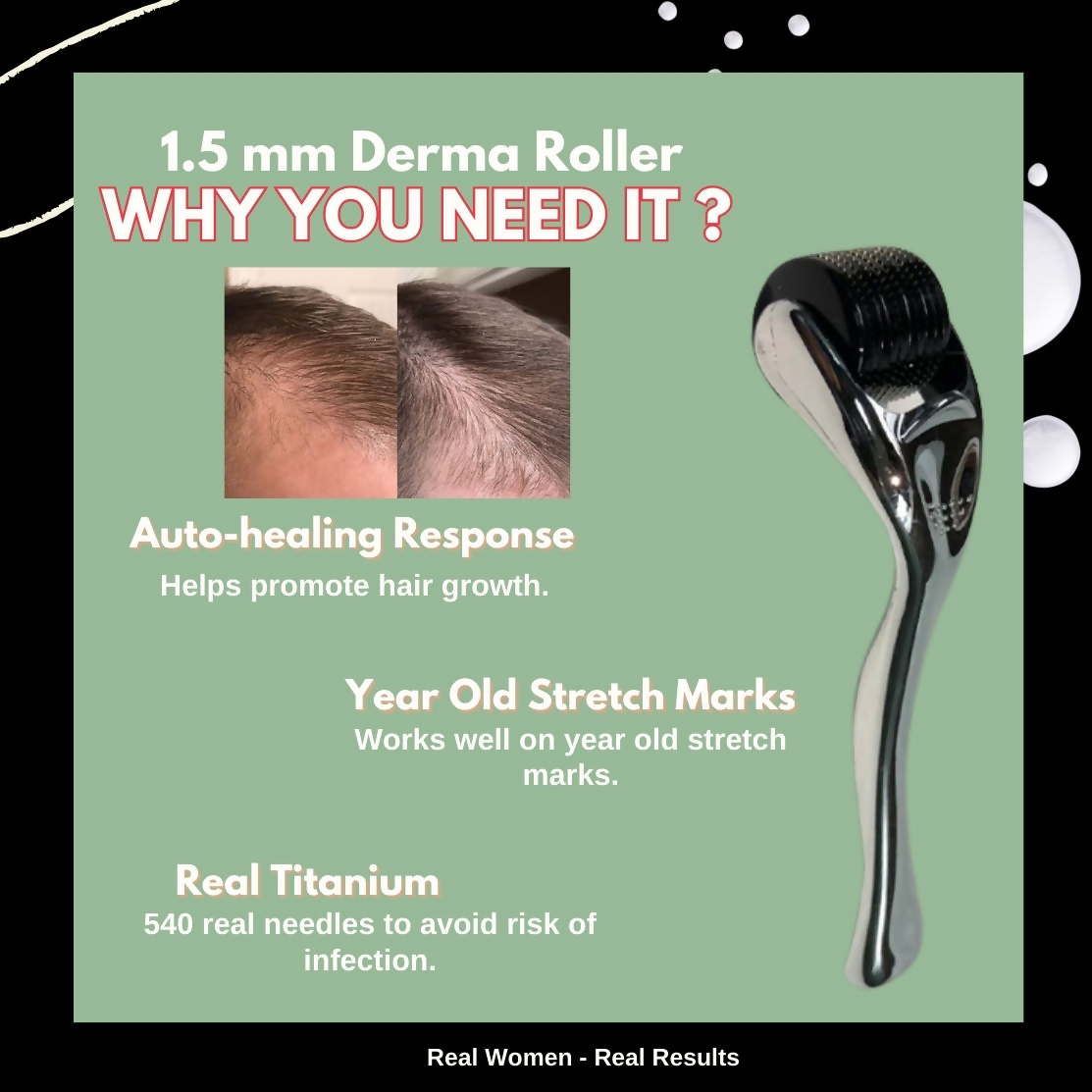 House of Beauty Derma Roller