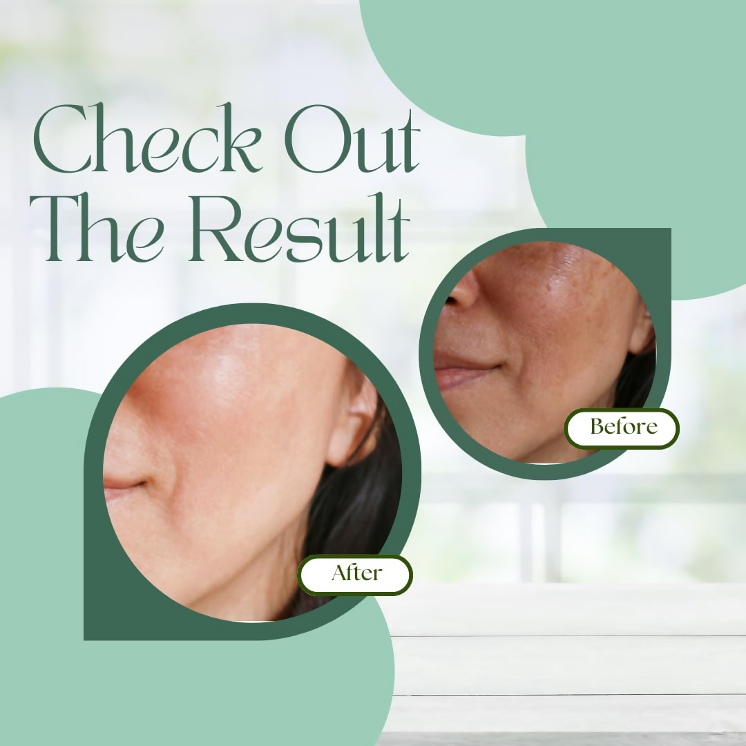 Skinaa Ocevia Skin Brightening Cream