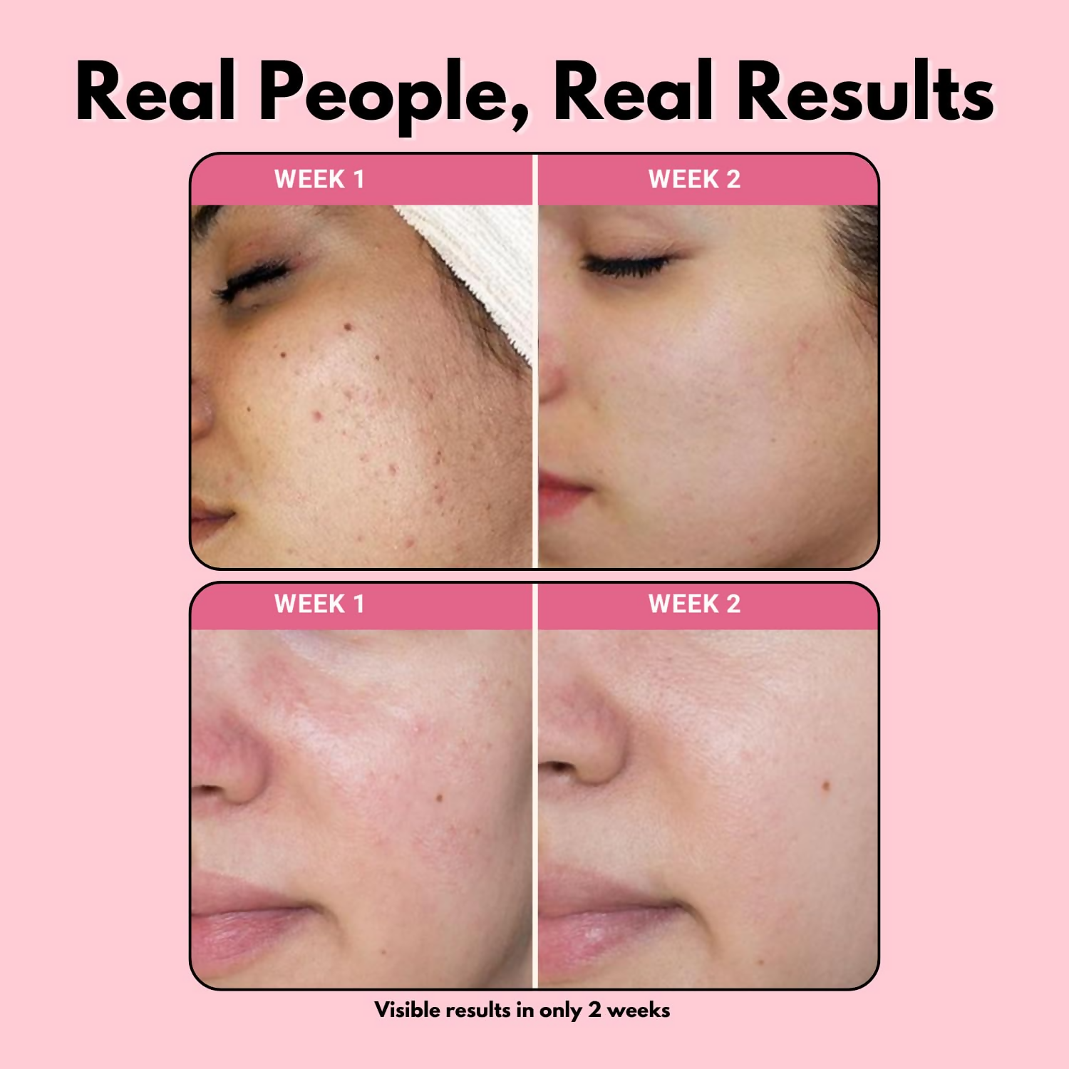 FSAS Health and Beauty Ultra Hydrating Ceramide Face Hydrator | Deep Moisturization