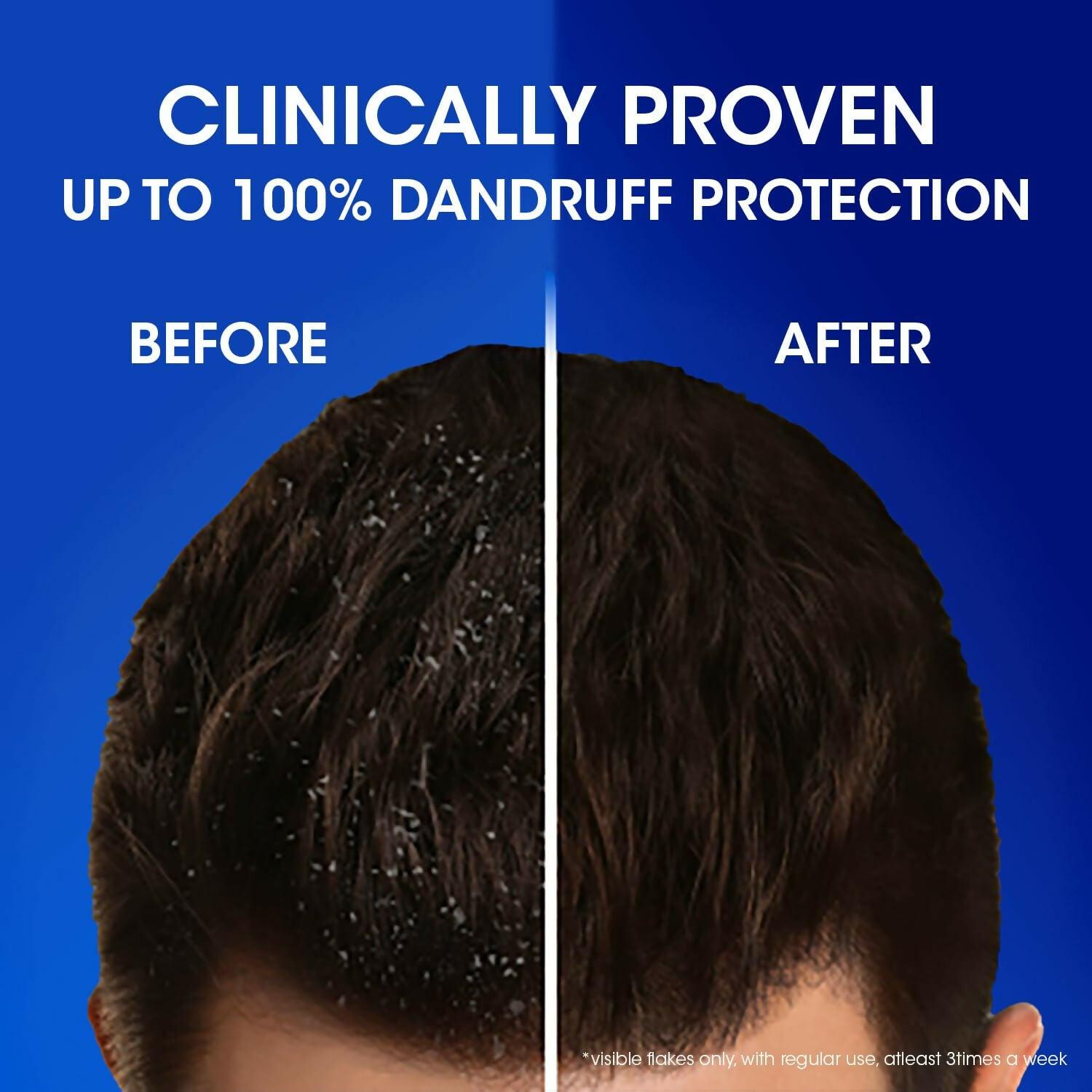 Head & Shoulders Silky Black Anti Dandruff Shampoo