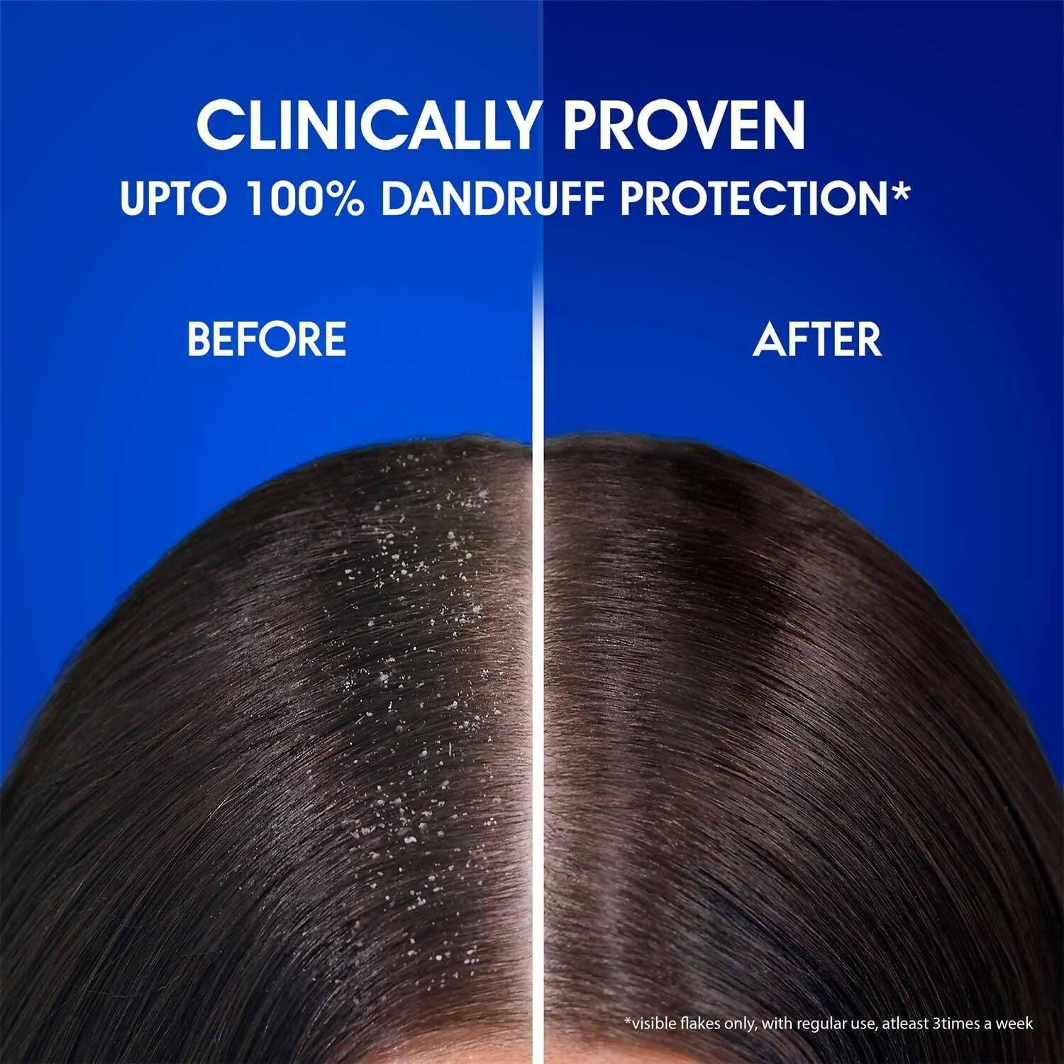 Head & Shoulders Silky Black Anti Dandruff Shampoo