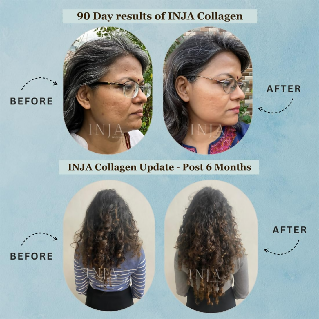 Inja Pro Marine Collagen Supplement For Women And Men For Healthy Skin