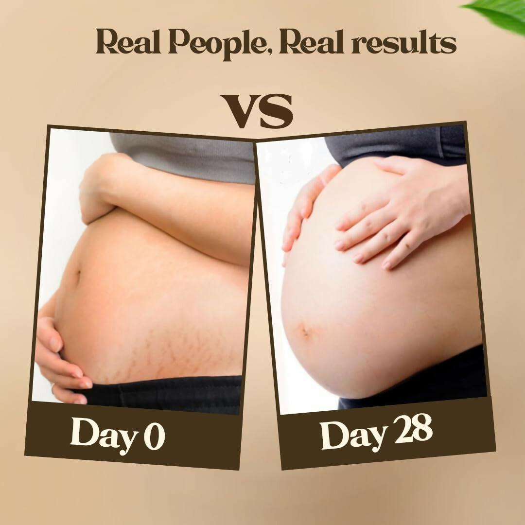 Pokonut Natural Stretch Mark Cream